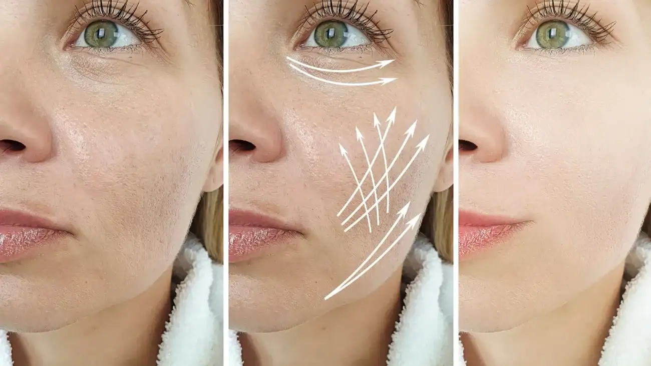 Can One Treatment Really Tackle More Than One Skin Concern Somerset ?