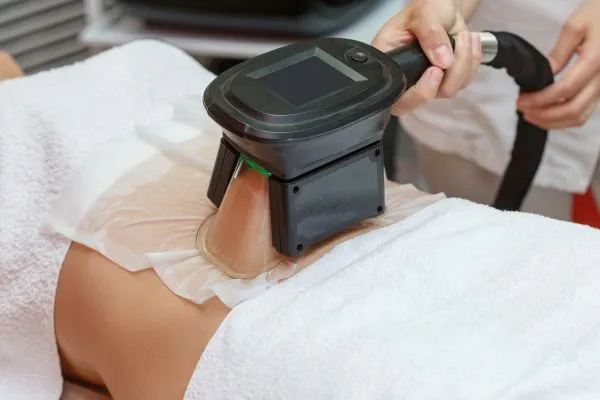 Image of person having fat freezing treatment to help weight gain Somerset