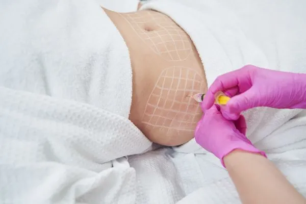 image of fat dissolving injections on love handles to help combat weight gain Somerset