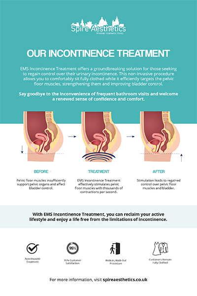 image to show how EMS treatment works for female urinary incontinence Somerset