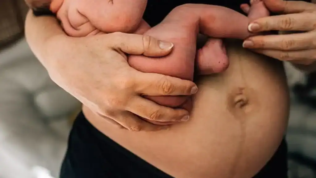Why Is My Stomach Still Big After Pregnancy Somerset ?